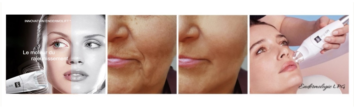Soin visage expert
